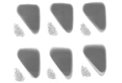 Identifizierung von minderwertigen Füllungen dank Dymond